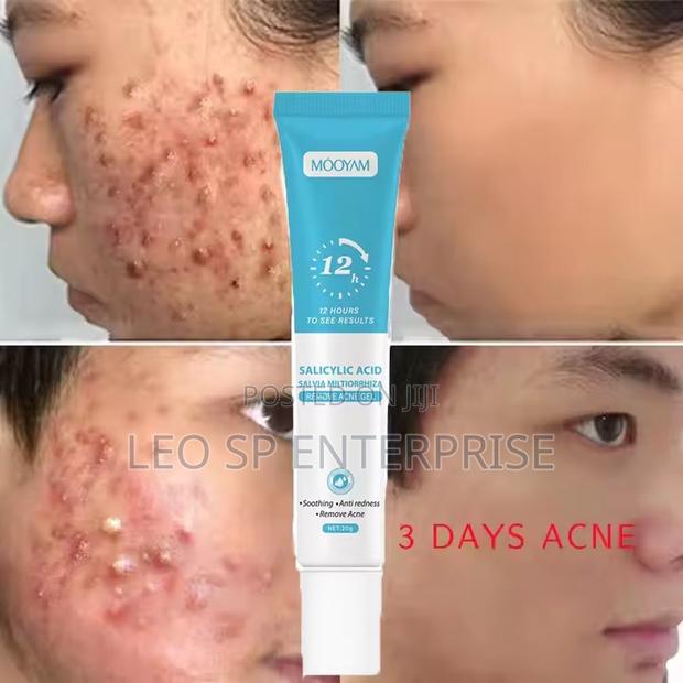 Pimples and Acne Cream · Photo 1