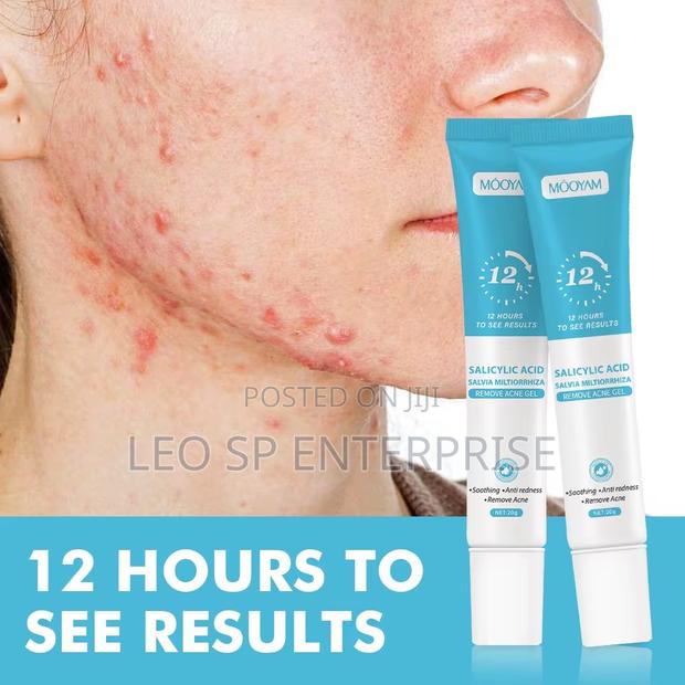 Pimples and Acne Cream · Photo 2