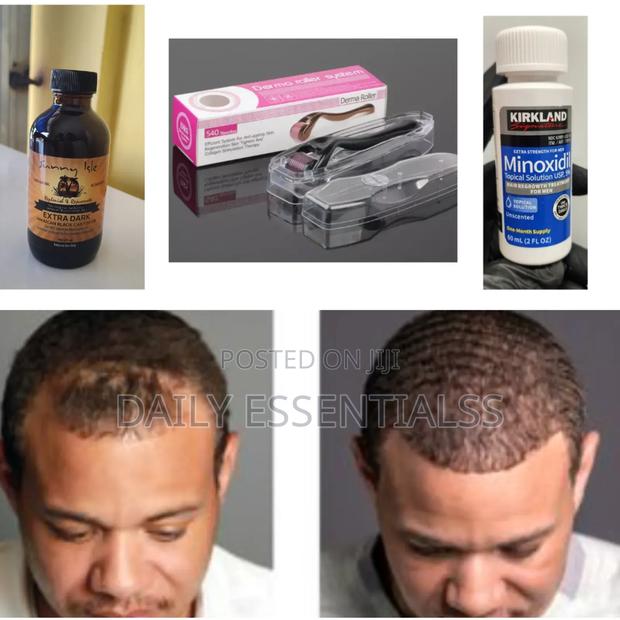 Thicker Hair Kit – Naturally Scientifically Backed · Photo 1