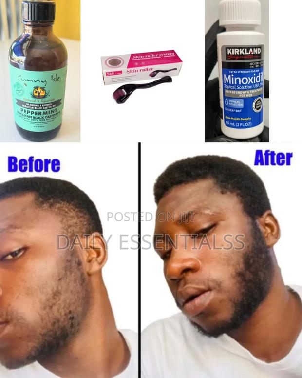 Kirkland + Peppermint Oil + Derma Roller Beard Hair Builder · Photo 1