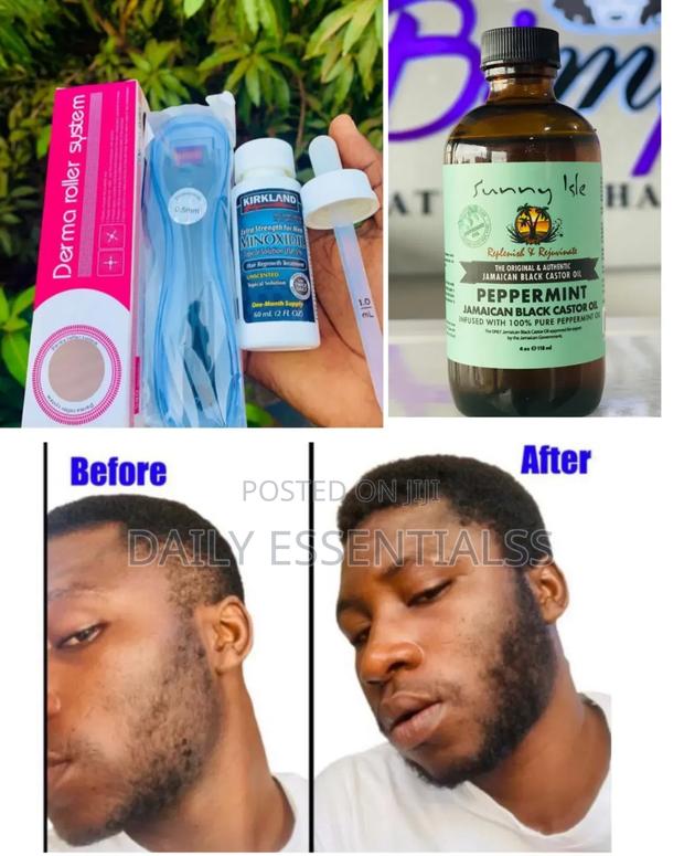 Kirkland, Derma Roller Peppermint – The Growth Team · Photo 1