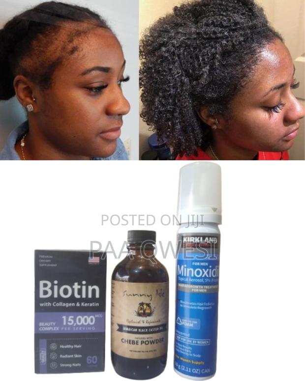 Triple Boost Hair Growth Set- Biotin + Foam + Chebe · Photo 1