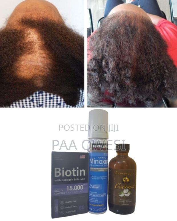 Full Hair Growth Trio - Biotin + Coconut + Foam · Photo 1