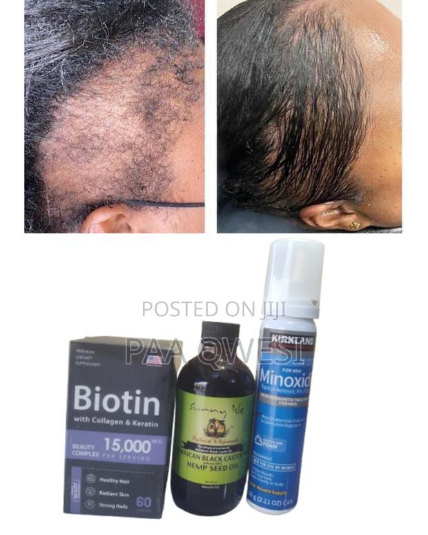 Biotin + Hemp Seed + Kirkland Foam · Photo 1