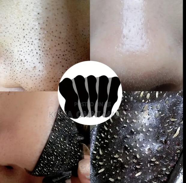 10pcs Nose Blackhead Remover Pore Strips · Photo 2