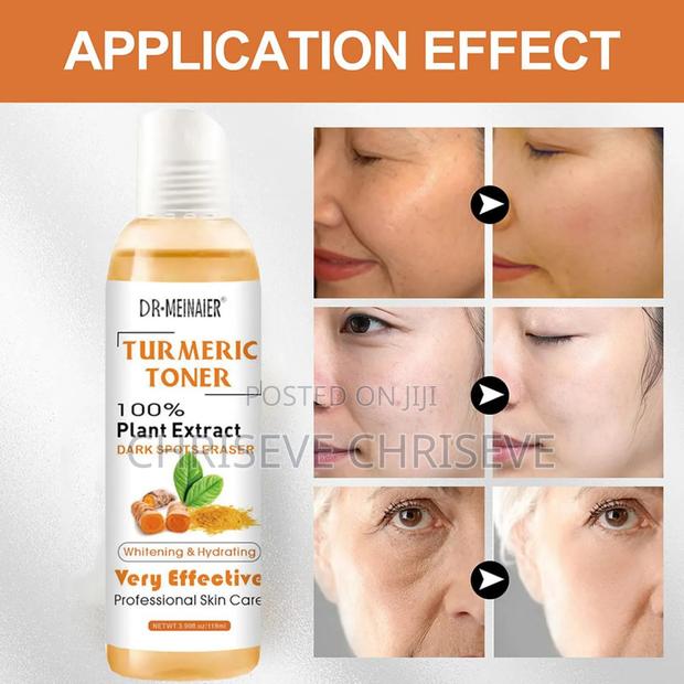 Tumeric Face and Neck Toner · Photo 3