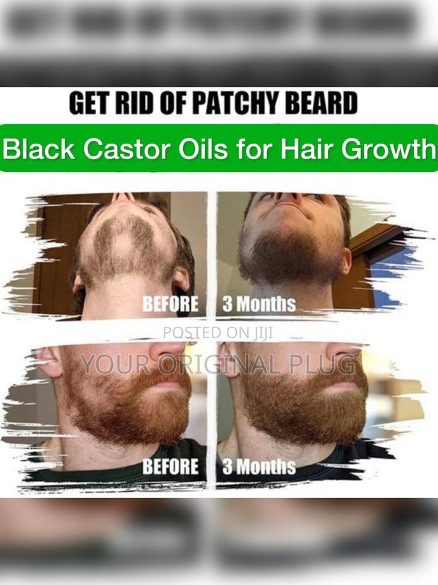 Jamaican Black Castor Oil, Extra Dark (Pure Blend) · Photo 6