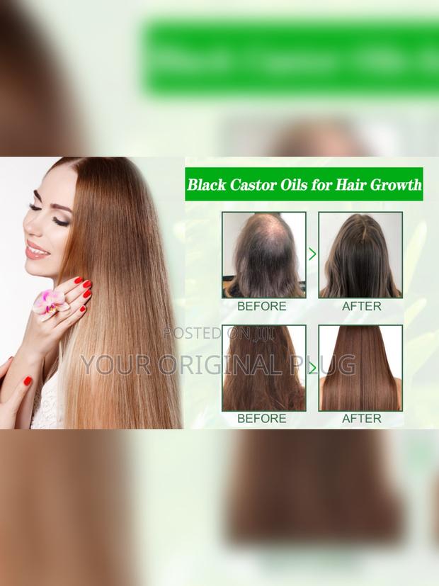 Jamaican Black Castor Oil, Extra Dark (Pure Blend) · Photo 5