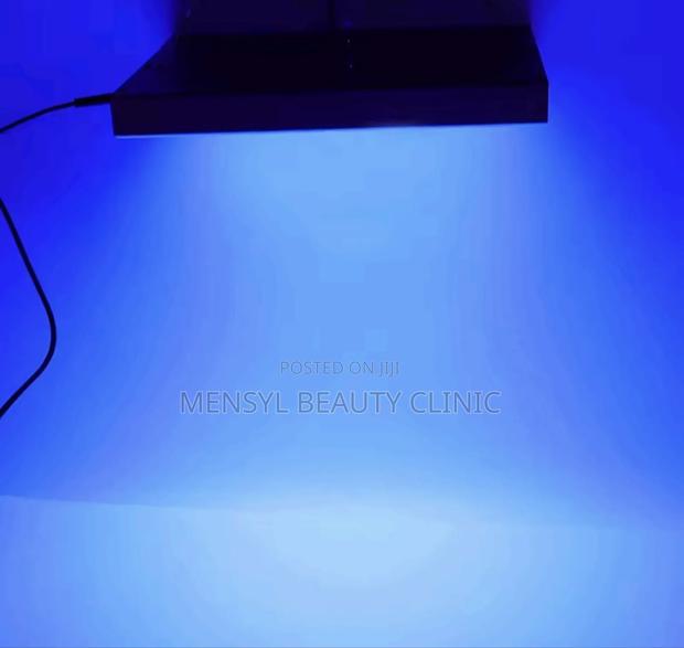 Blue Light Therapy Good for Severe Acne,Pimples Loss of Energy · Photo 5