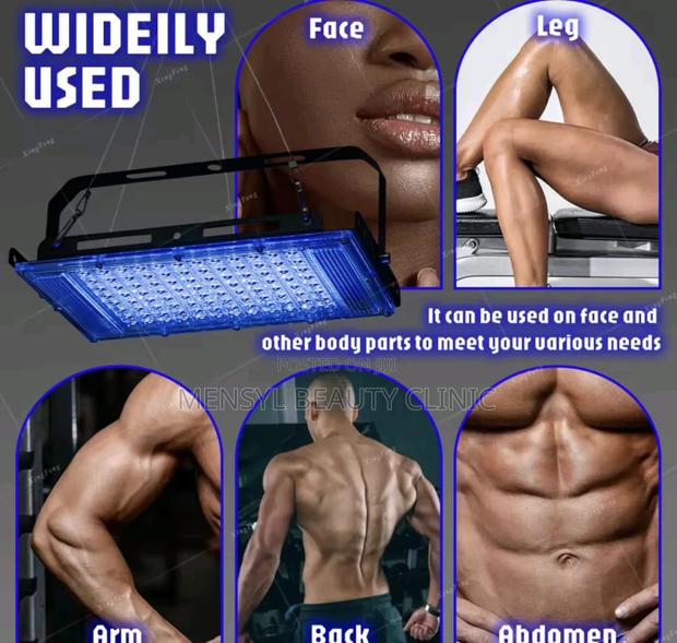 Blue Light Therapy Good for Severe Acne,Pimples Loss of Energy · Photo 2