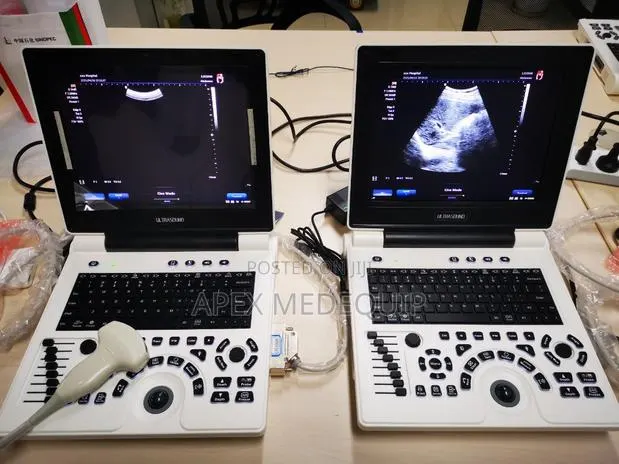 Brandnew SonoTec Portable Ultrasound Scan Machine + 1 Convex Probe · Photo 1
