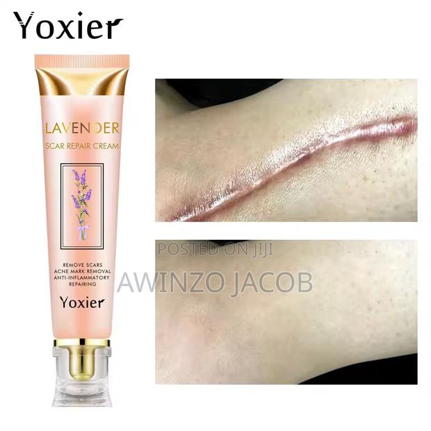 Original Yoxier Scar Remover · Photo 2