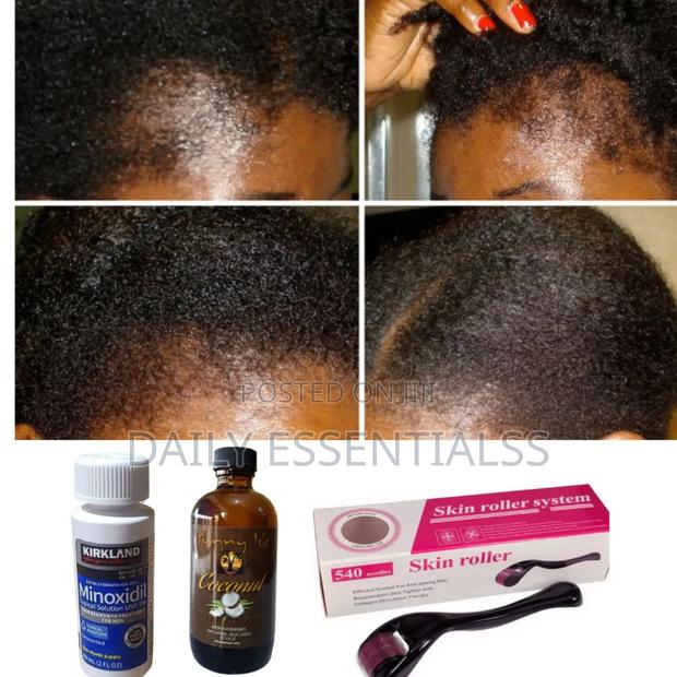 Kirkland , Coconut Oil + Derma Roller for Hair Regrowth · Photo 1