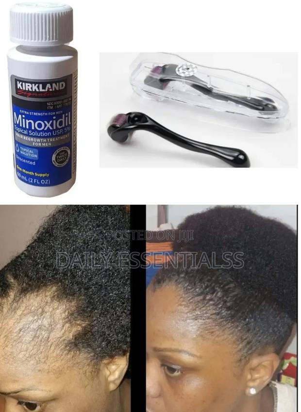 Kirkland Derma Roller Kit · Photo 1