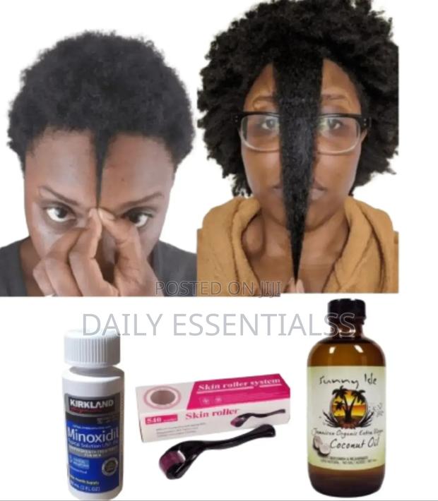 Minoxidil, Roller Sunny Isle Coconut Oil Combo · Photo 1