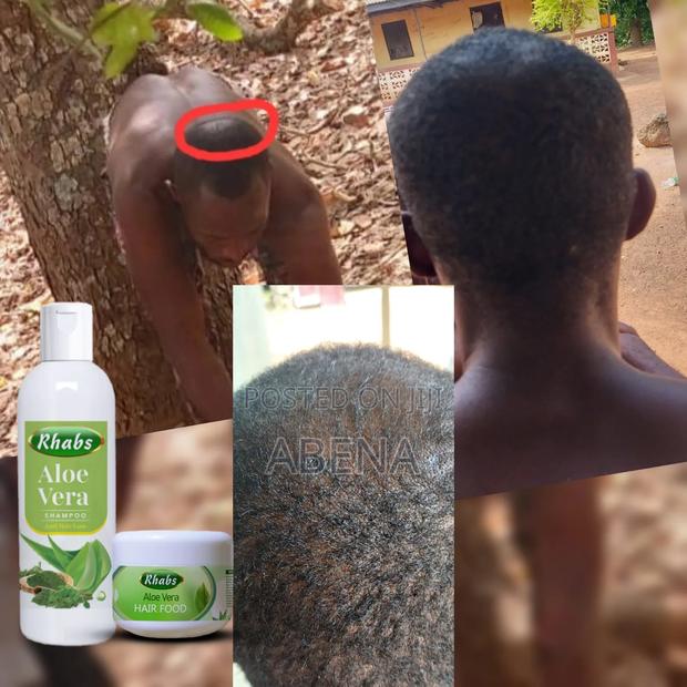 Bald Head Solution · Photo 1