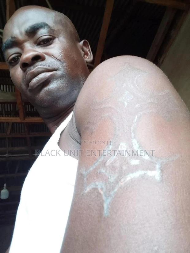 Tattoo Removal · Photo 2