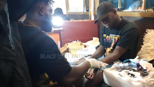 Tattoo Removal · Photo 5