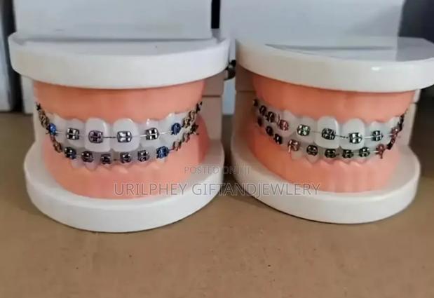 Fashion Braces · Photo 2