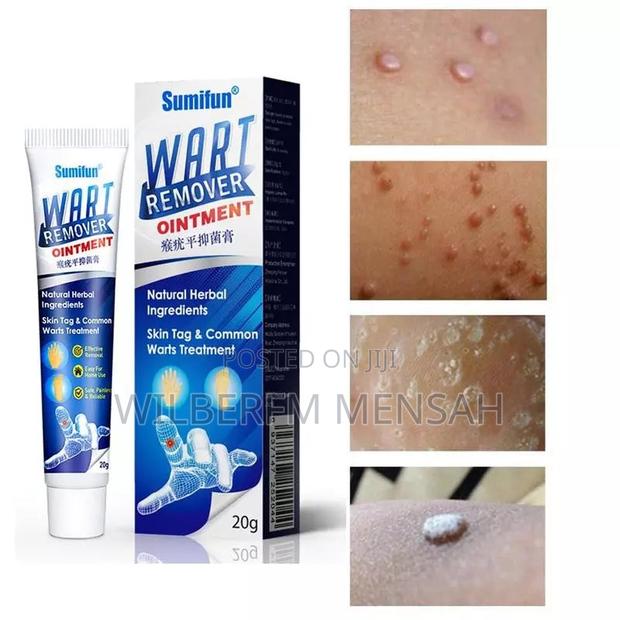 Wart Remover Ointment · Photo 2