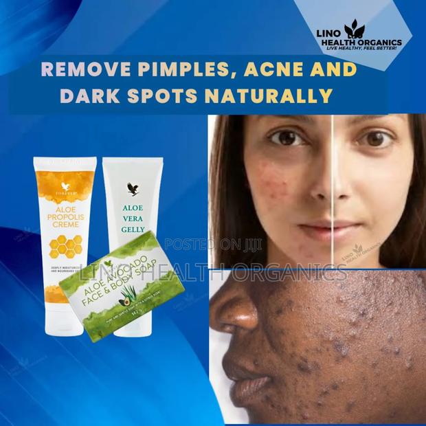 Pimples, Acne and Dark Spots Removal Pak · Photo 1