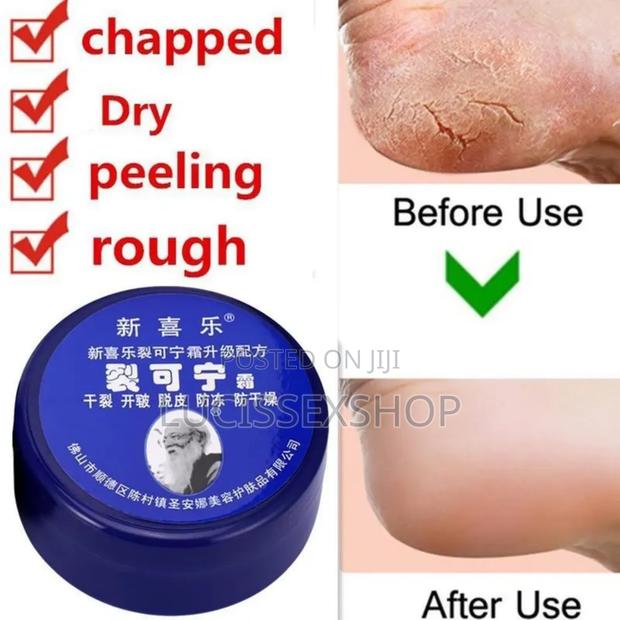 Anti Crack Foot Cream · Photo 2