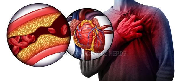 Heart Attack Stroke Remedy · Photo 1