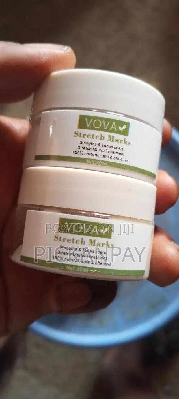 Stretch Mark Cream and Oil