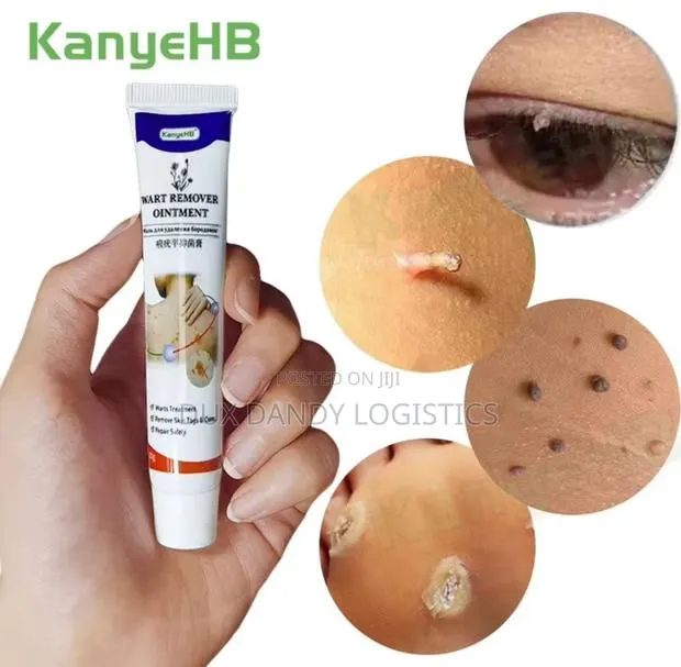 Wart Remover Ointment · Photo 1