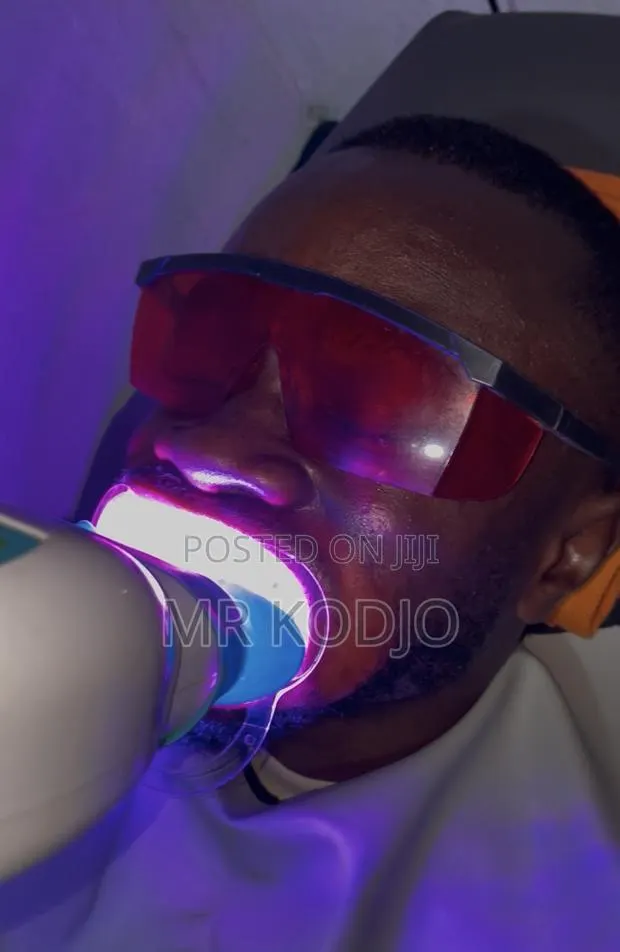 Teeth Whitening Service · Photo 1