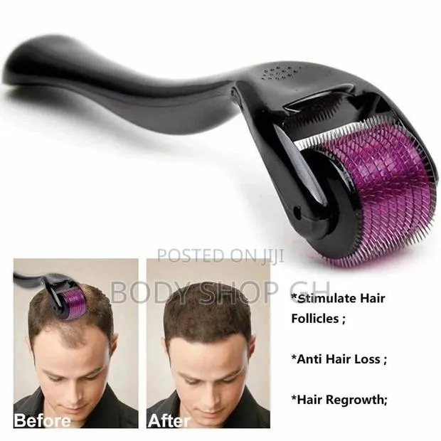 0.5mm Micro Needle Derma Roller for Receding Hairlines · Photo 1