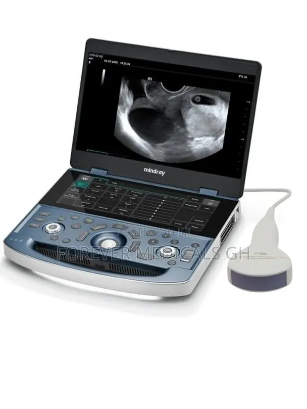 Mindray Dp 10 Ultrasound Scan Machine With Convex Probe · Photo 1