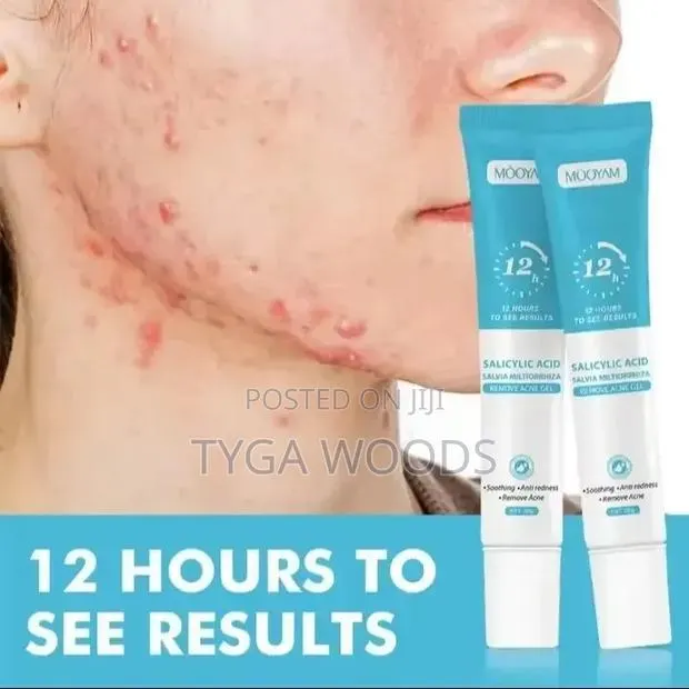 Pimples and Acne Cream · Photo 1