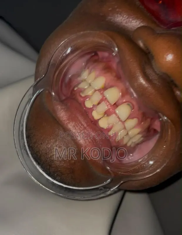 Teeth Cleaning · Photo 1