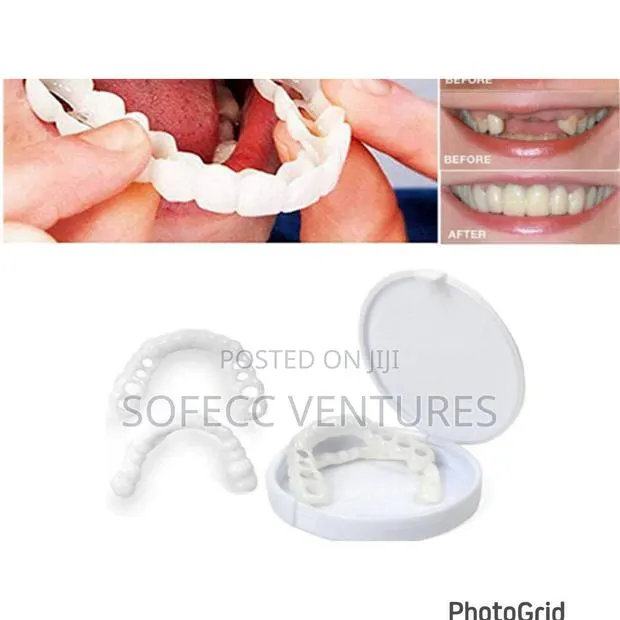 Simulated Braces/Fake Teeth · Photo 1