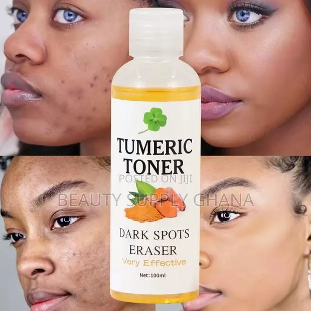 Turmeric Toner – Dark Spots Eraser · Photo 1