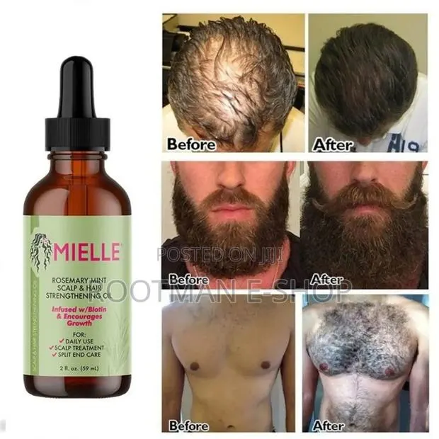 Mielle Rosemary Mint Oil (Hair/Beard) · Photo 1