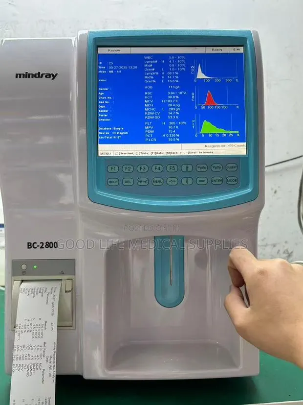 Hematology Analyzer (Fbc Machine) · Photo 1