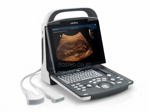 Ultrasound Machine (Mindray) Dp 10 · Photo 1