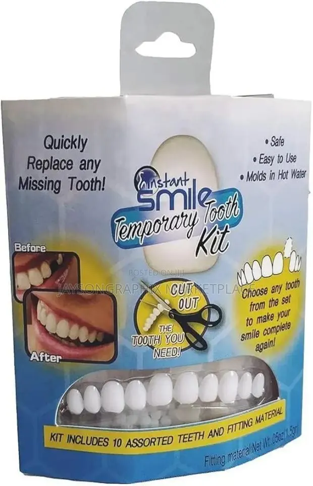 Instant Smile Temporary Tooth Kit · Photo 1