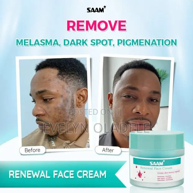 Saam Renewal Cream