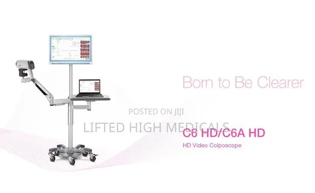 Edan C6hd Digital Video Colposcope for Gynecology · Photo 1