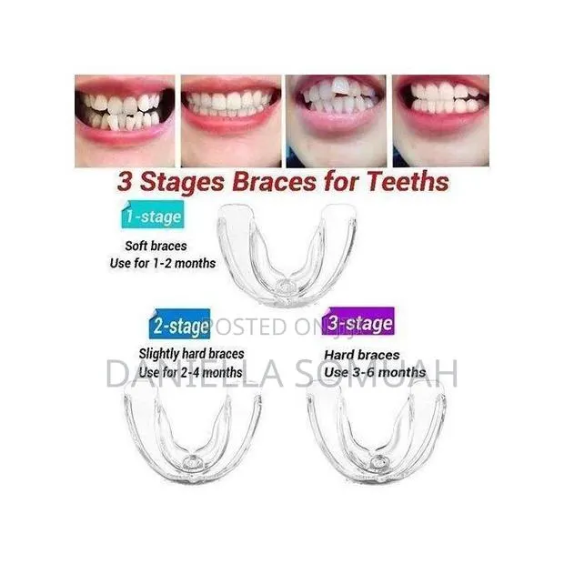 Teeth Aligners, Invisible Braces · Photo 1