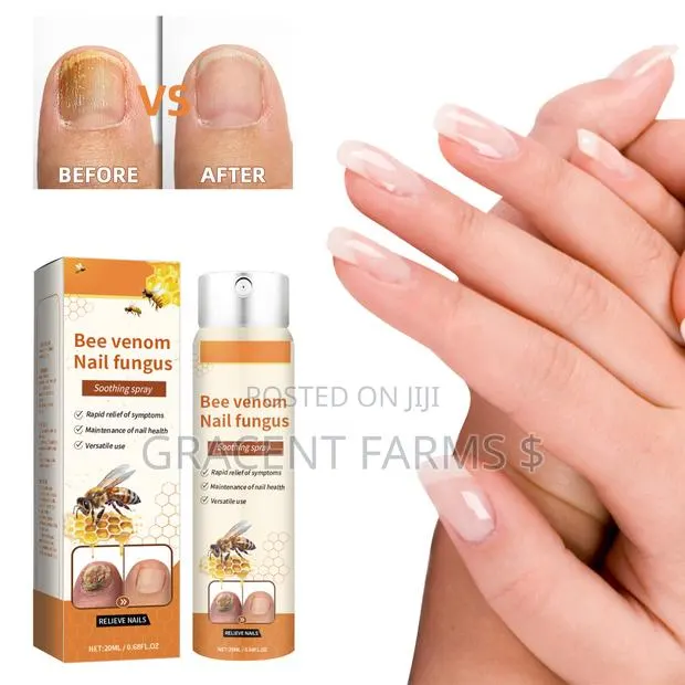 Bee Venom Nail Fungus Soothing Spray. · Photo 1