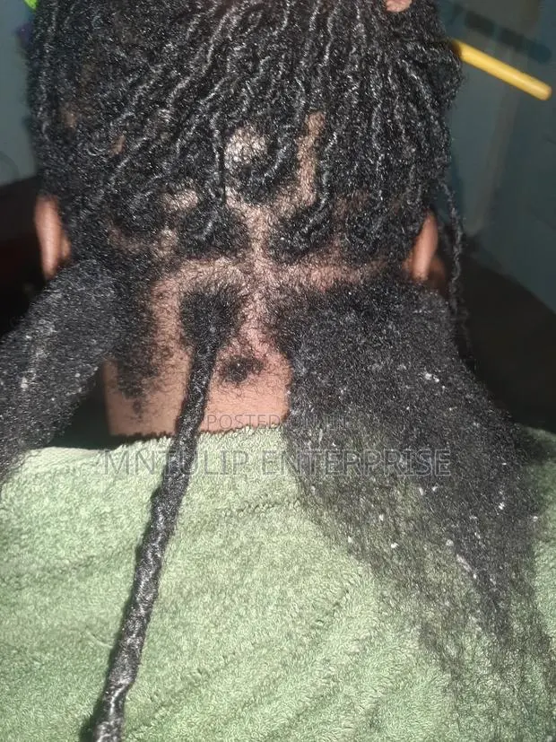 Dreadlock Unlocking · Photo 1