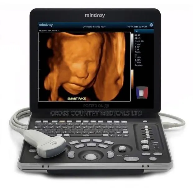 Ultrasound Scan Machine(Mindray) · Photo 1