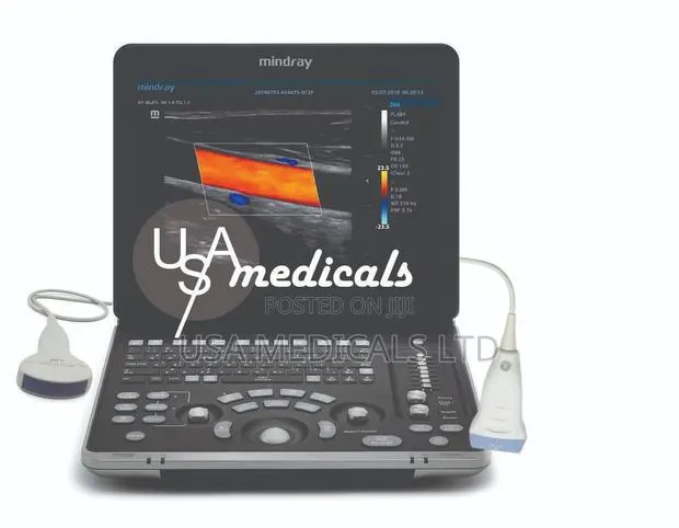 Mindray Z60 Ultrasound Scan Machine ( Linear + Convex Probes ) · Photo 1