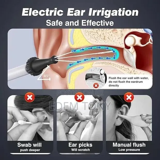 Electric Ear Wax Removal Kit, Ear Suction Wax Remover · Photo 4