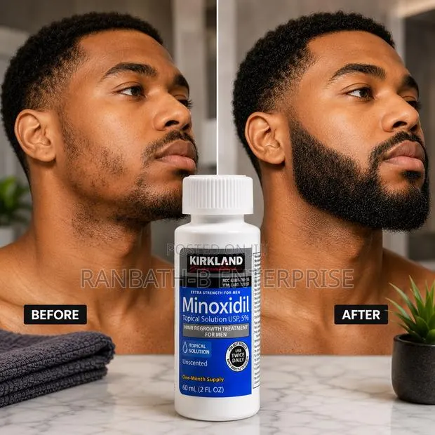 Original Kirkland Minoxidil – Quality You Can Trust · Photo 1