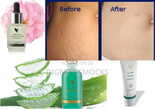 Stretch Marks Remedy · Photo 1